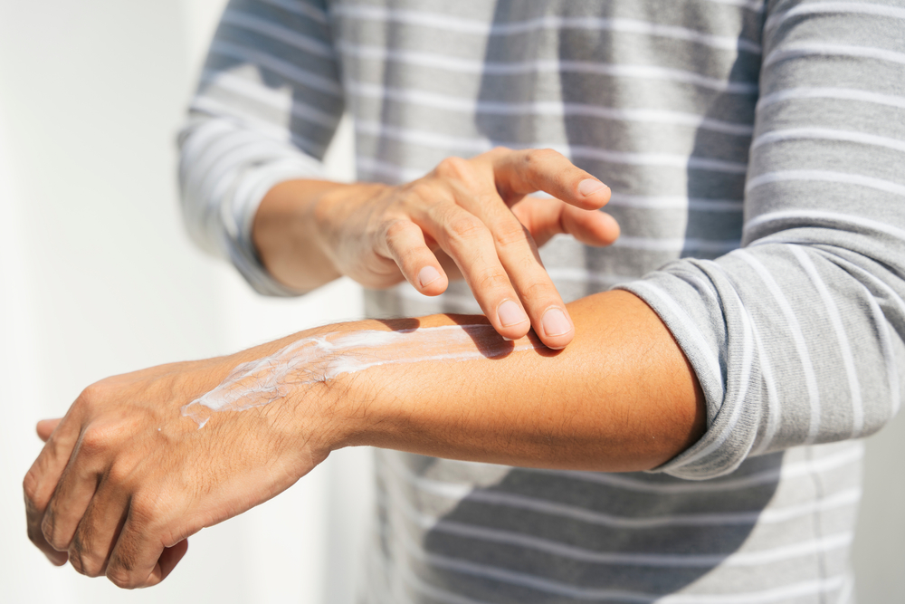 It is recommended to apply sunscreen to your hands every time you step outside.