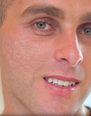 Smiling man’s face in close-up, showing skin without scars